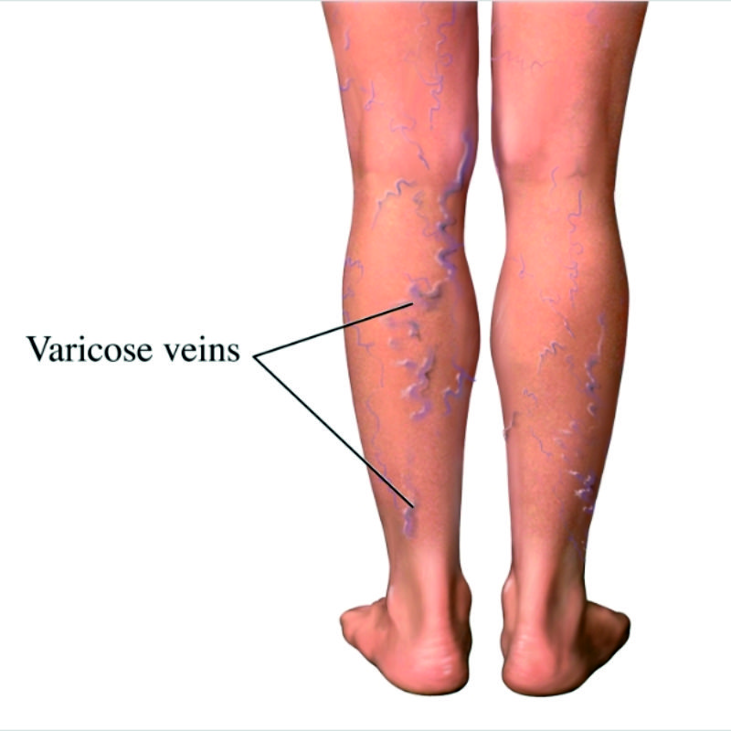 Dr. Ravi Vascular Center Vein Clinic
